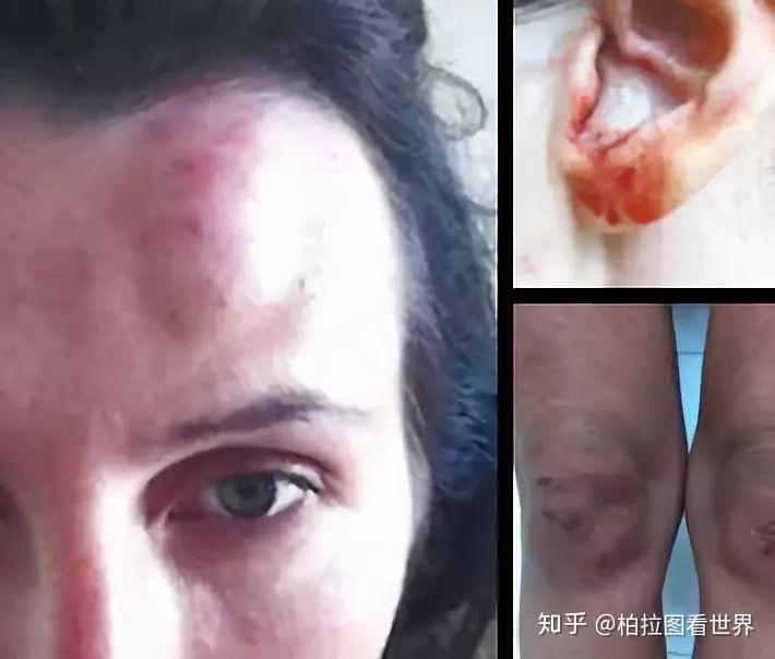 第一个在微博承认家暴的男星如果道歉有用要警察干什么