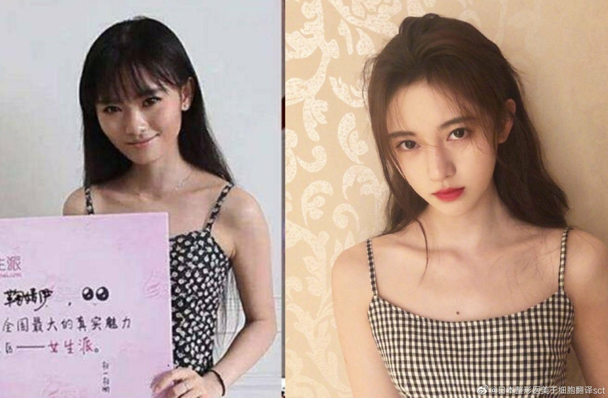 鞠婧祎到底有没有整过容?