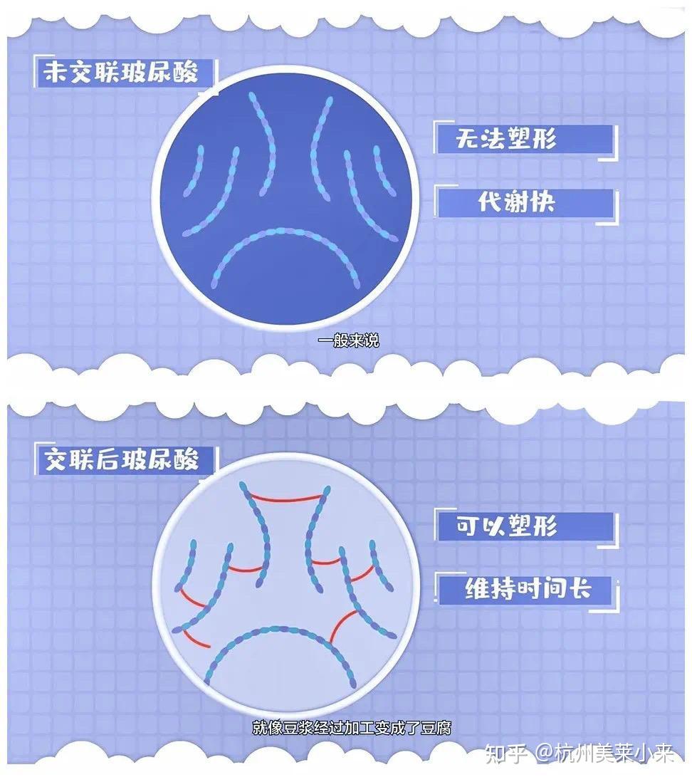 交联玻尿酸和非交联玻尿酸有什么区别