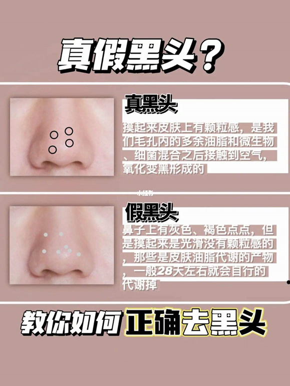 去黑头怎么办千万不要被坑了建议收藏