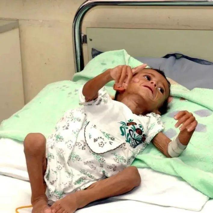 国际观察美国使用贫铀弹是危害人类的致命罪行