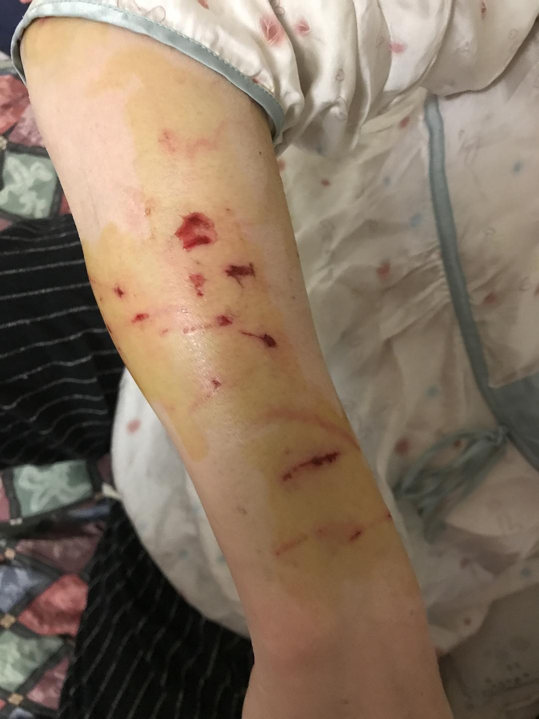 如何解决猫咬人/攻击人行为? - 知乎