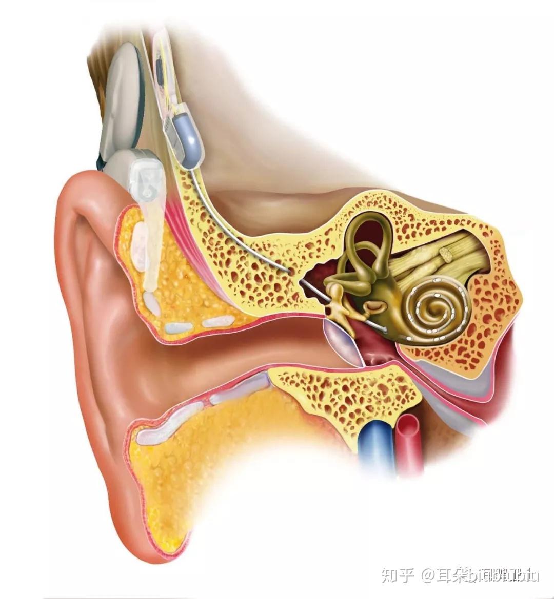 外耳道损伤 鼓膜损伤,医疗图片素材_高清图片素材