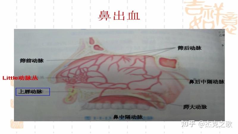 耳鼻喉科 耳鼻喉科常见急症处理 ppt课件 - 知乎
