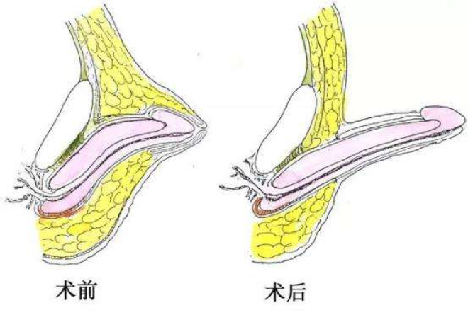 铁裆功的原理是什么呢