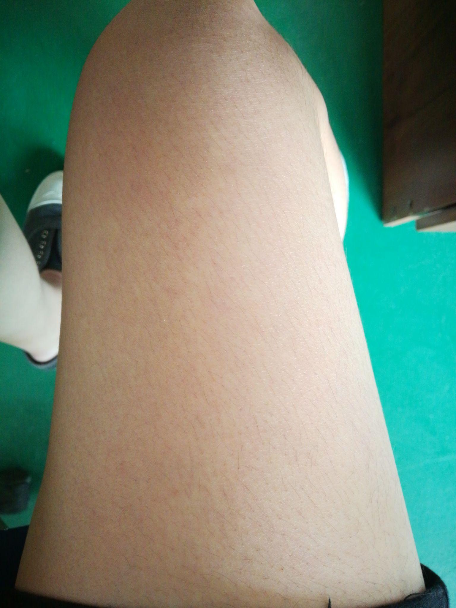 女生可是手臂上汗毛长又多,夏天怎么办好? - 知乎