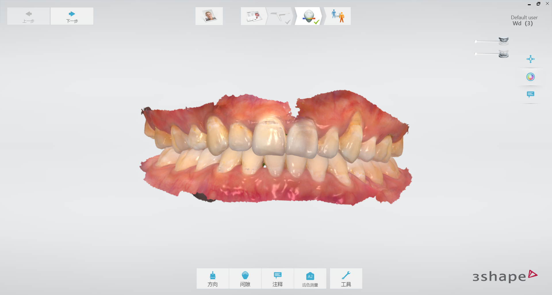 3shape口扫应用数据传输