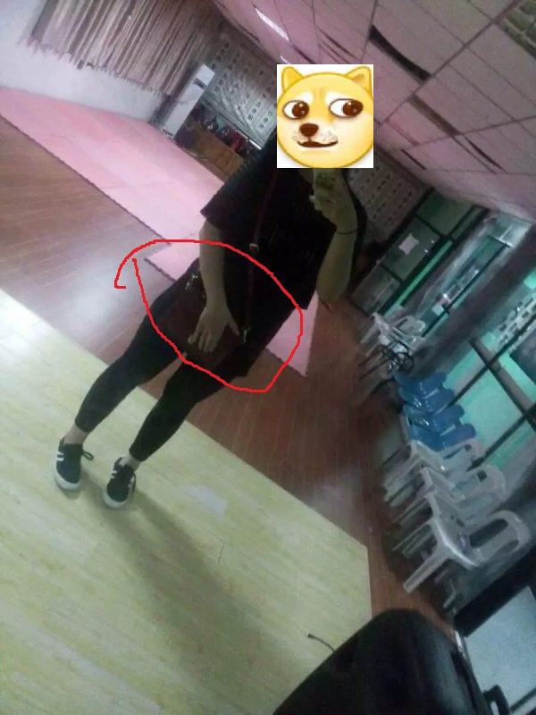 从小腹上面那一圈就开始胖,胖到整个大腿,四肢也比较粗大,就脸和上