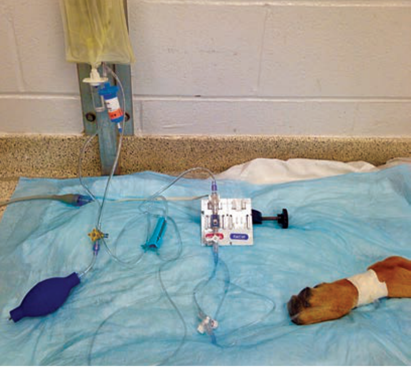 从护理角度看血压监测第一部分血压监测概述