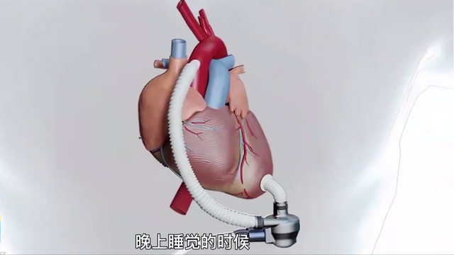 "人工心脏"的奥秘