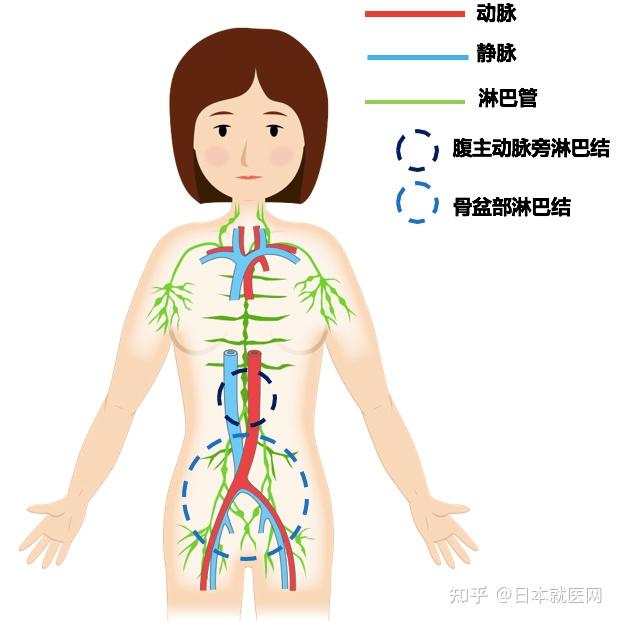 癌症术后并发症