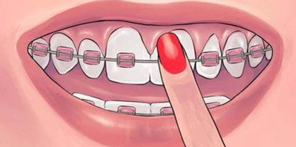 怎么说话不露下齿 v2-8c4215def493e56b44ff69c692d37a1e_1440w.jpg?source=172ae18b