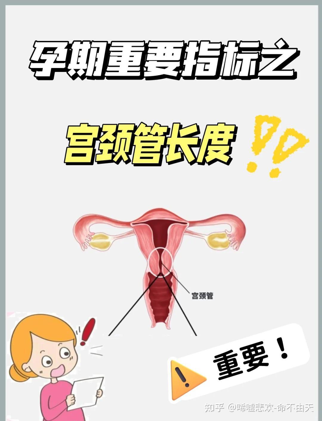 你是否想搞清楚以下关于宫缩的问题：什么叫宫缩，宫缩的注意事项，孕期是否需要关注宫颈管长度，宫缩和宫颈管长度的相互关系，开宫口了必须马上生产吗 ...