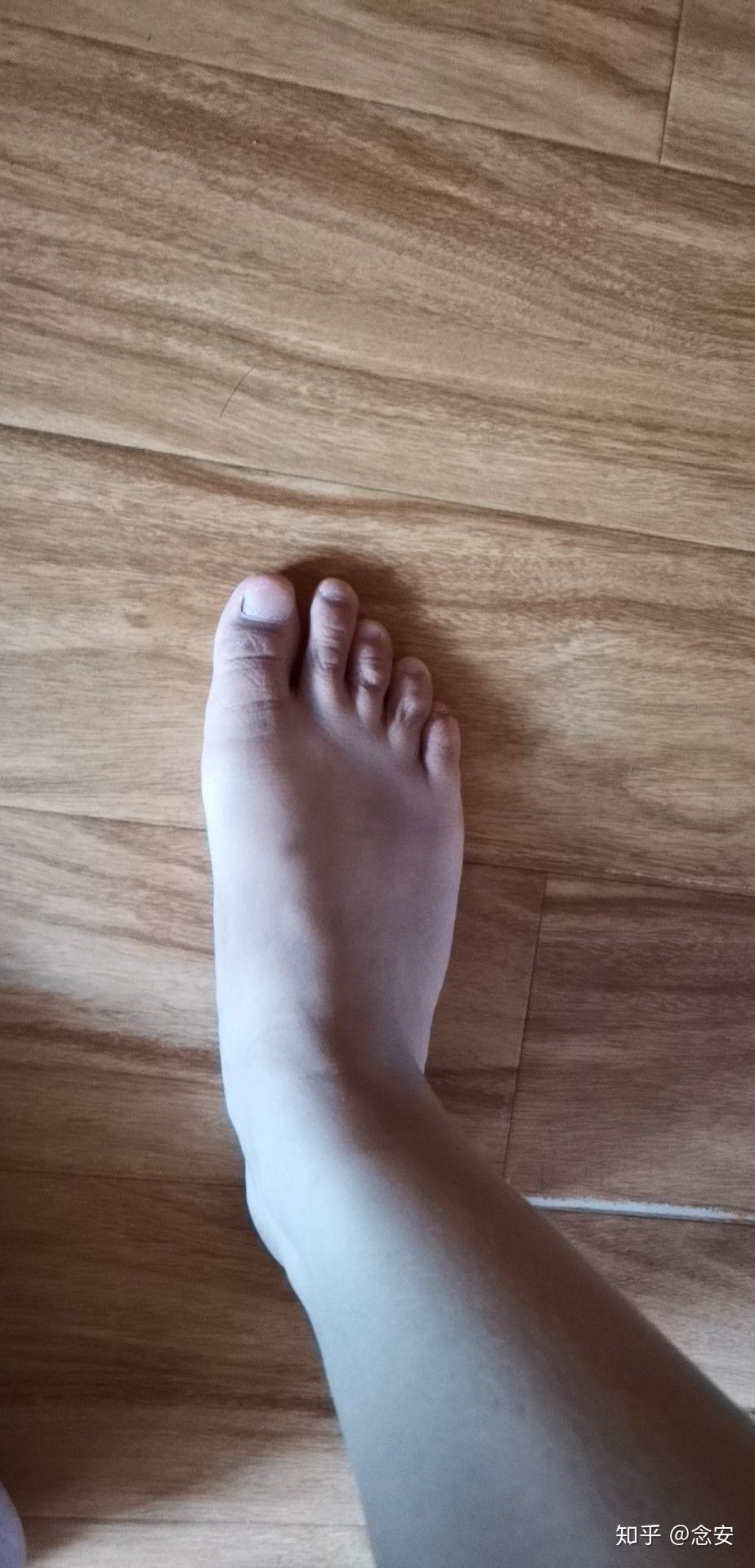 女生脚丑是种什么样的体验? - 知乎