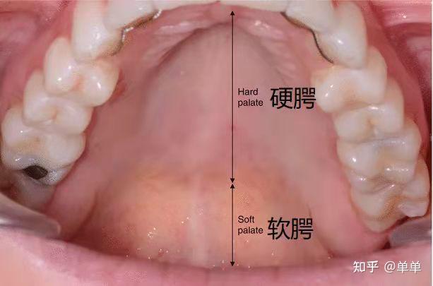 咽腭弓腭舌弓图片