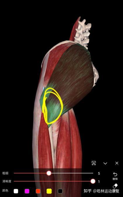 以使肌肉足够松弛,要实现有效持久的释放,往往还要检查腘绳肌,股直肌