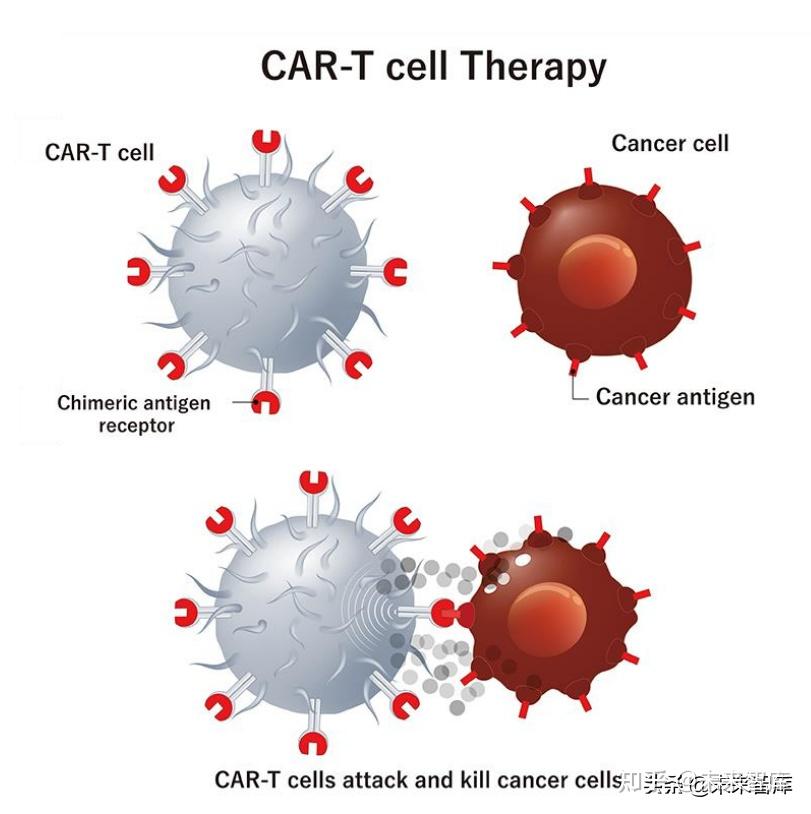 医药car-t行业研究报告:曙光纷至,朝阳若现 - 知乎