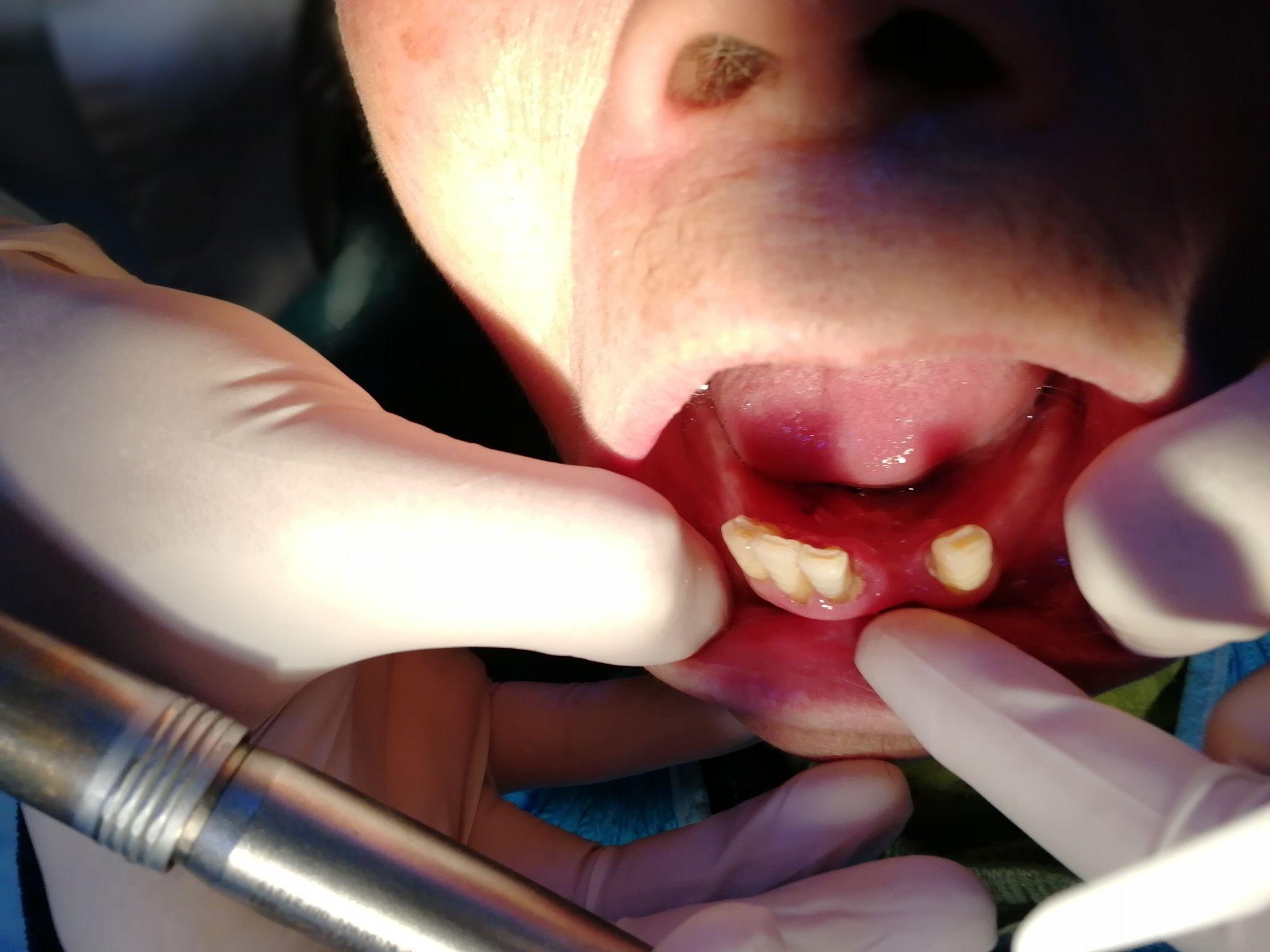 a4567b567c4567d124567缺失