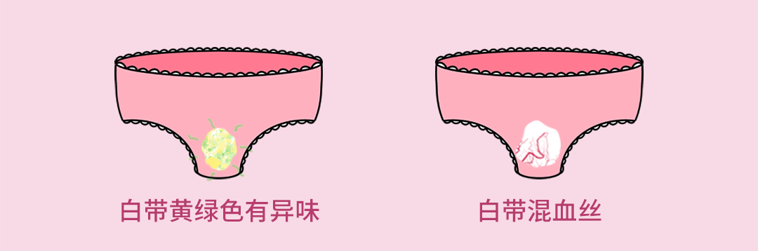 最全[白带异常]自诊指南，你的白带正常吗？ - 知乎