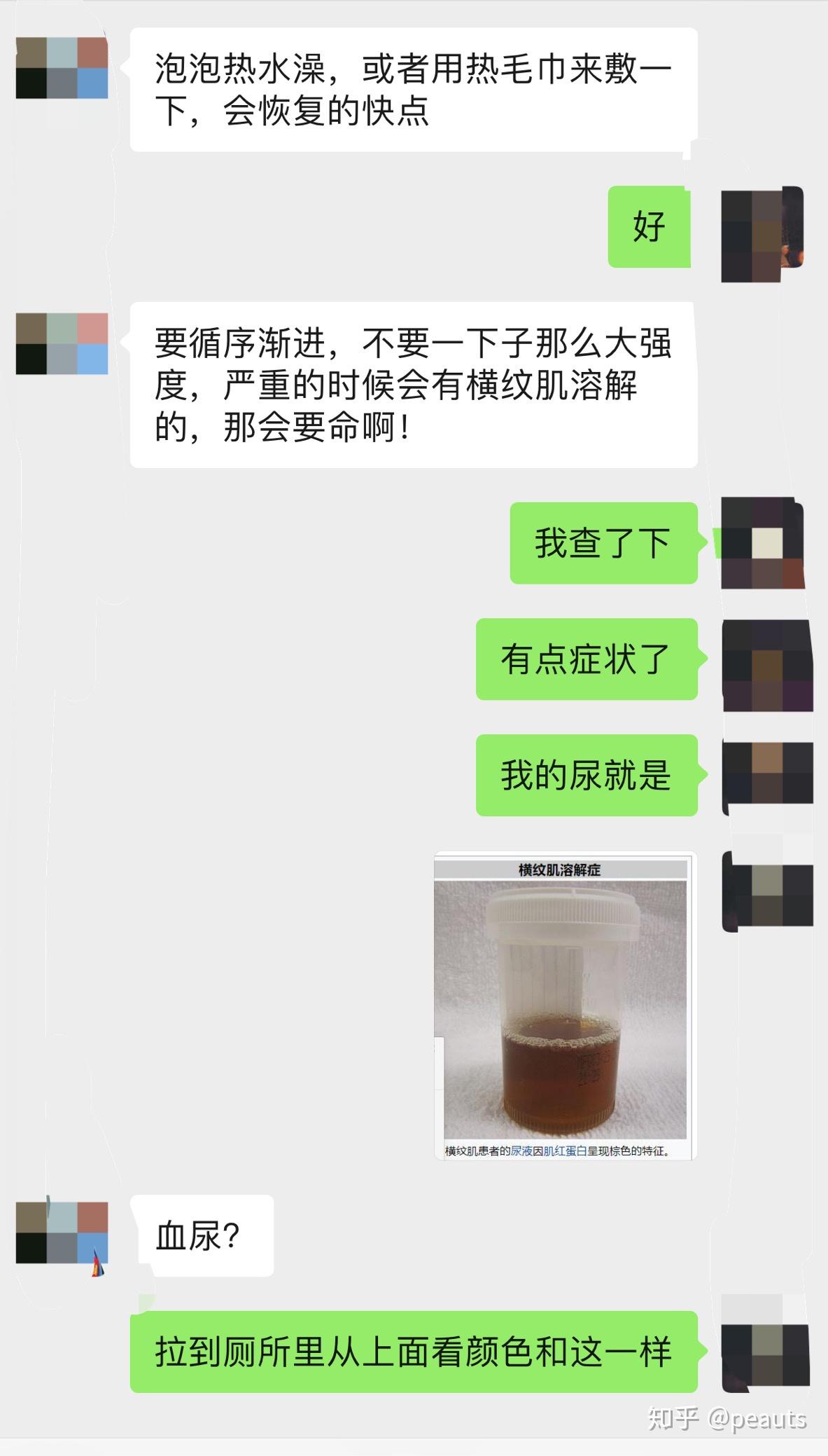 横纹肌溶解症你好初次见面