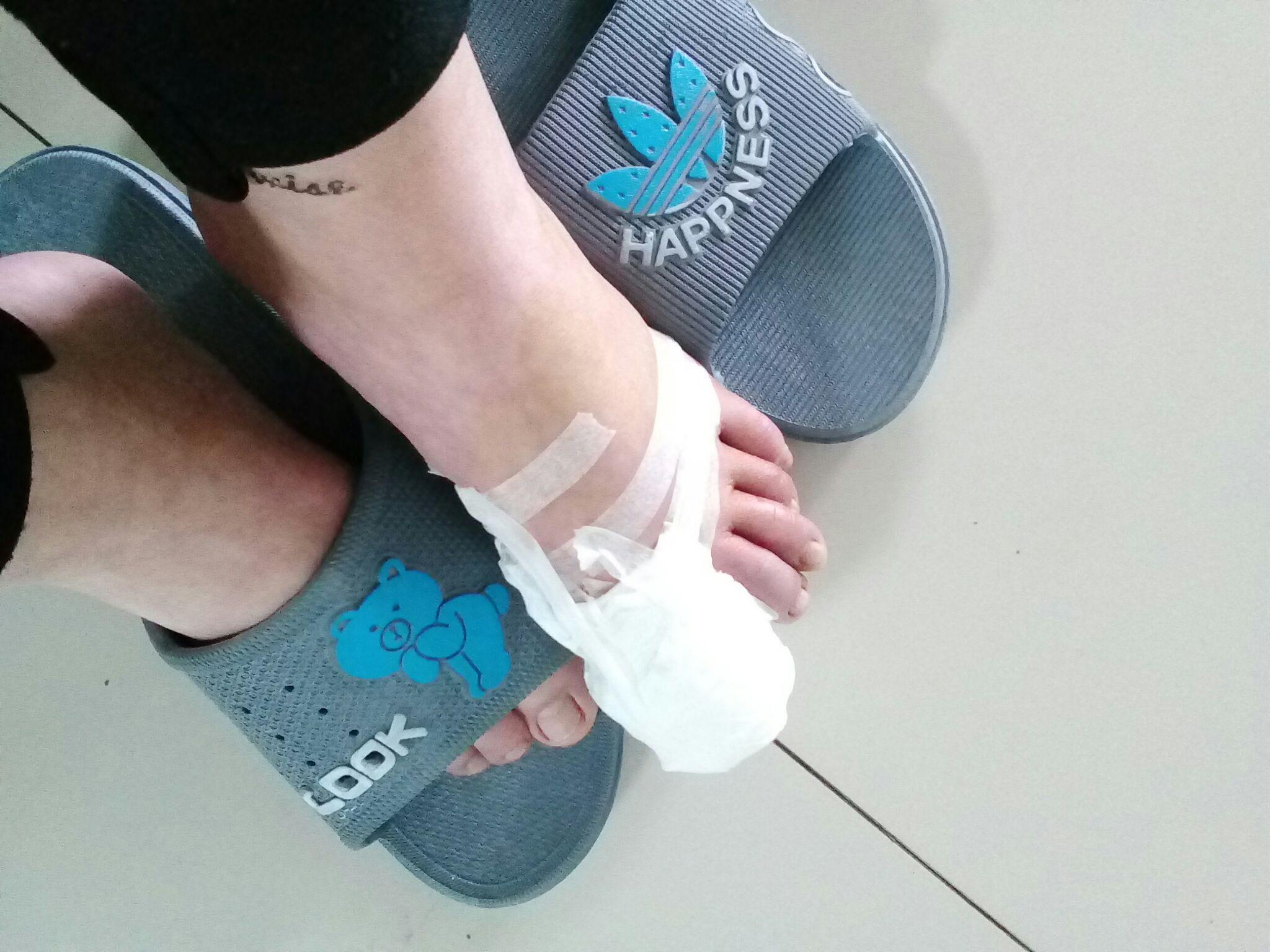 甲沟炎拔甲是怎样的体验?