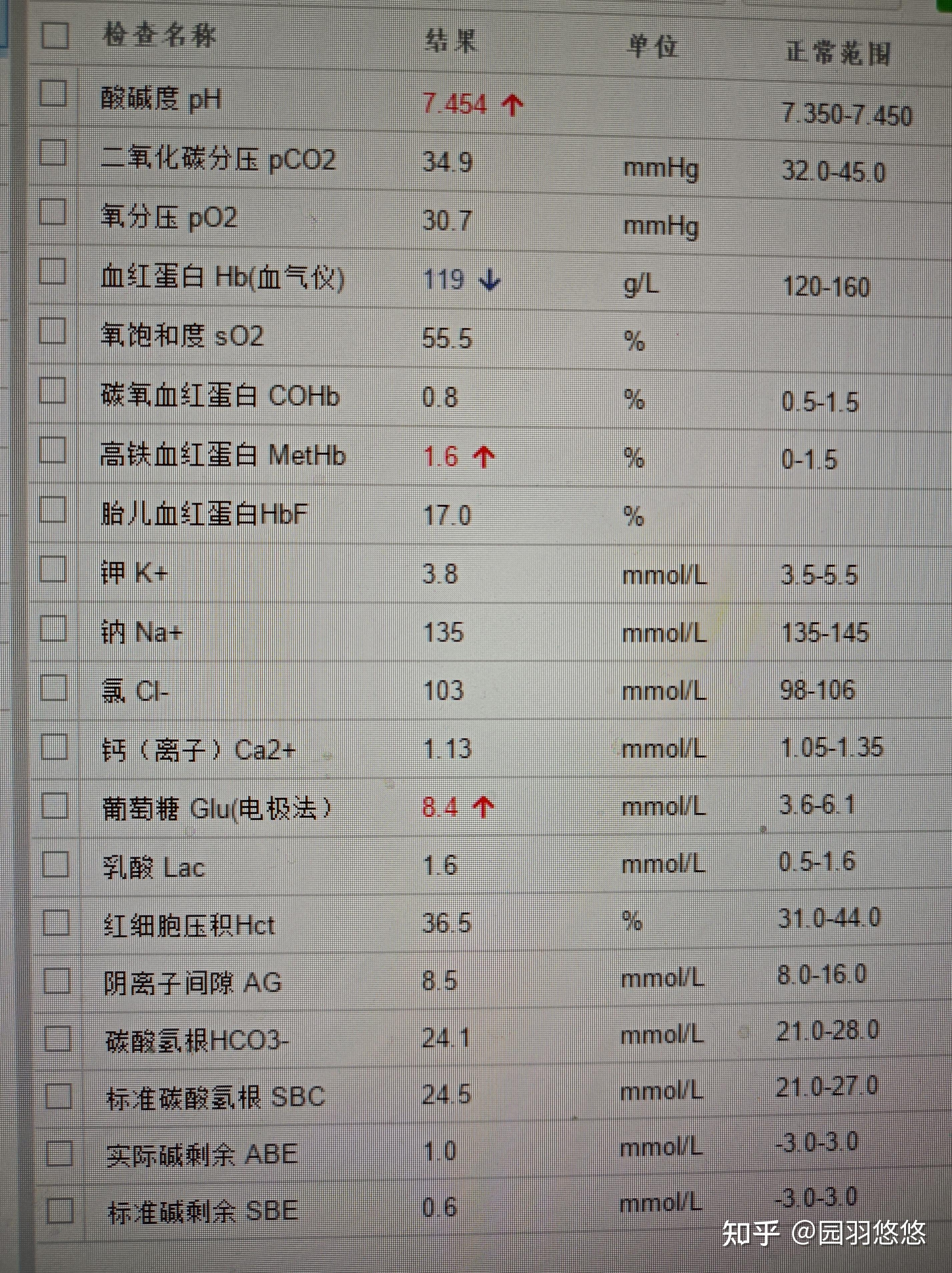 免疫球蛋白报告图片