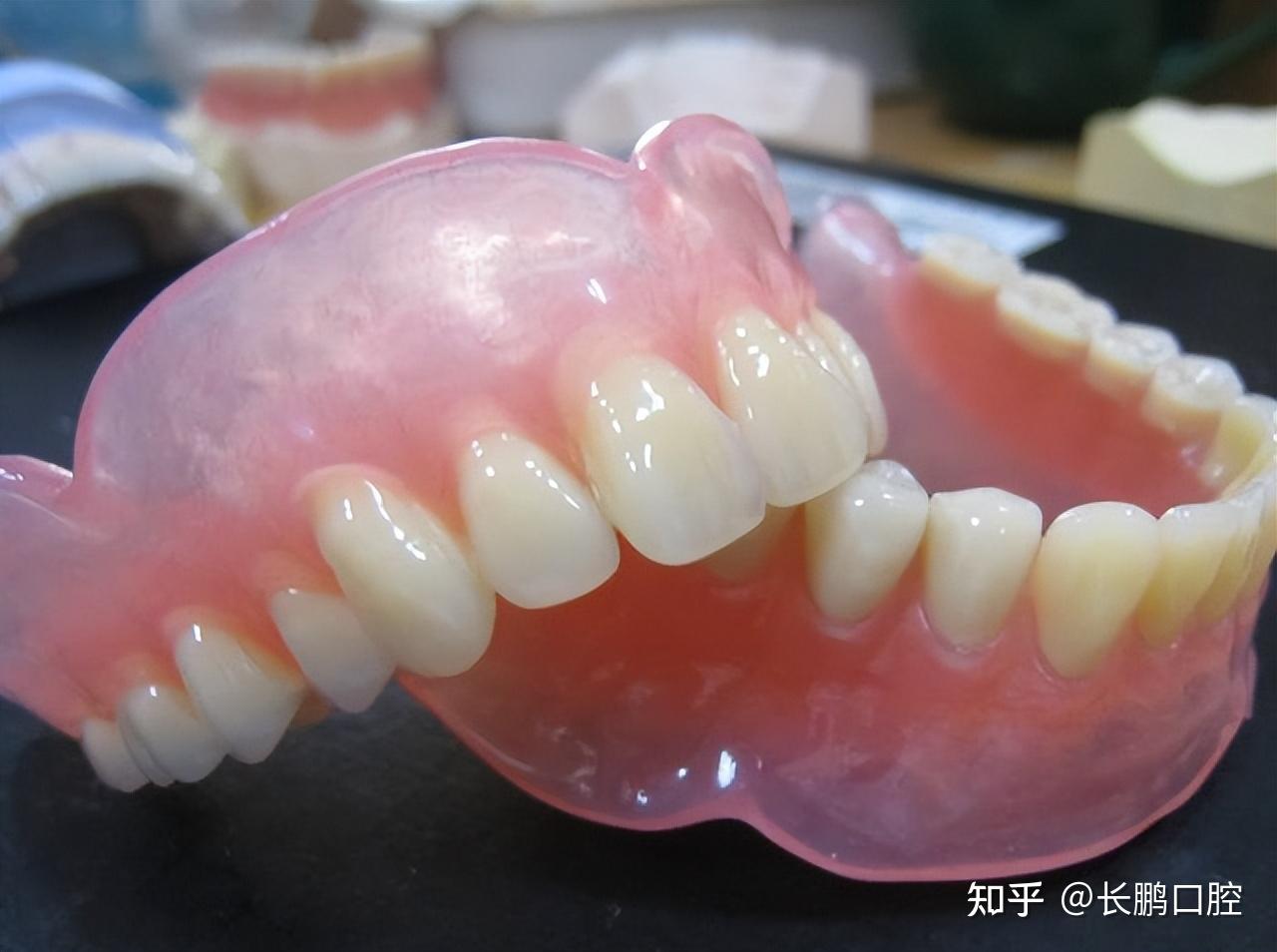 全口吸附性义齿和普通义齿牙比较后的区别在价格和材质上-儿牙-妈妈好孕网