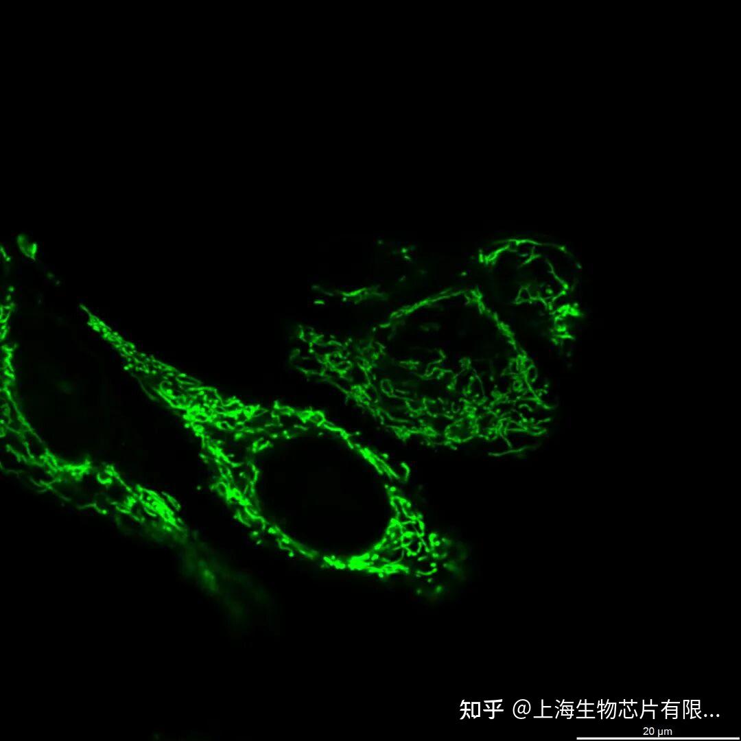 Dapi 405 亚细胞结构超高分辨显微成像系列——内质网 - 知乎