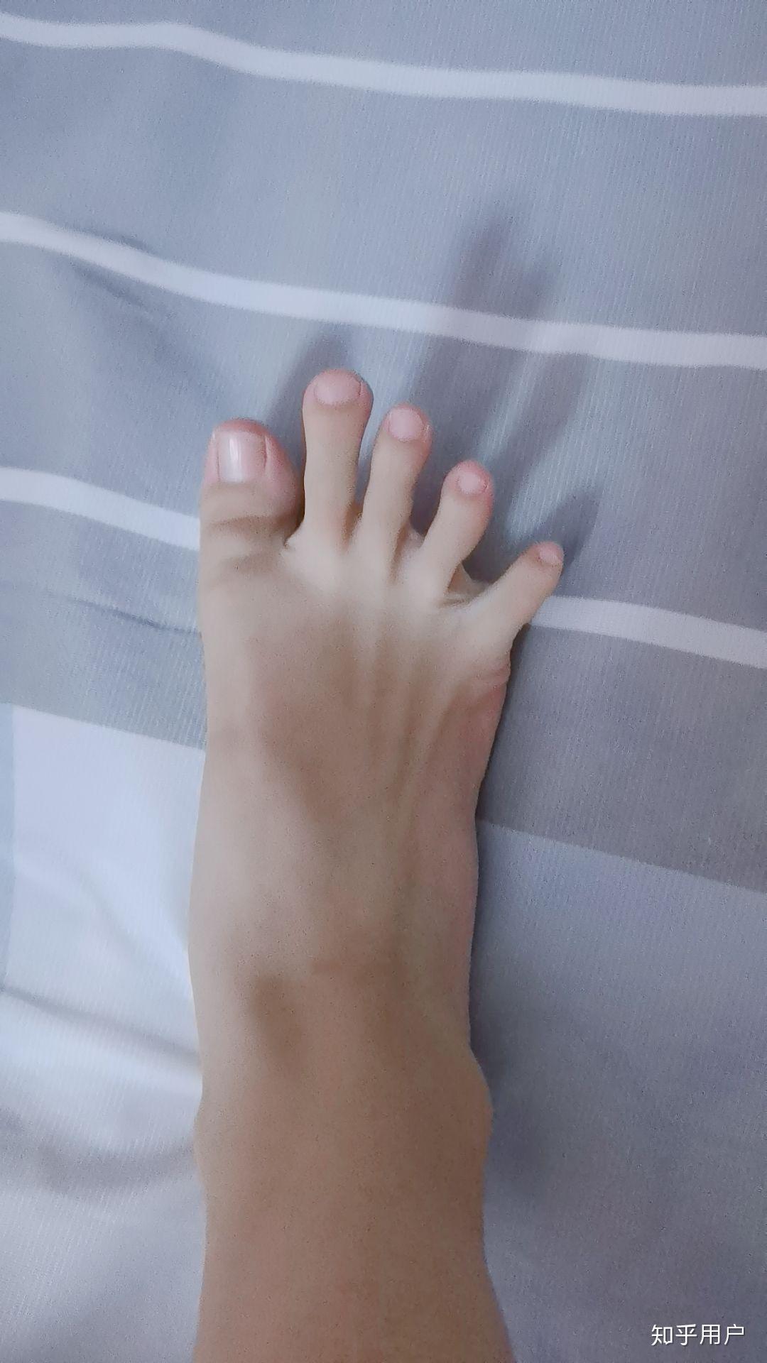 拥有希腊脚的女生真的有更大的可能是美女吗