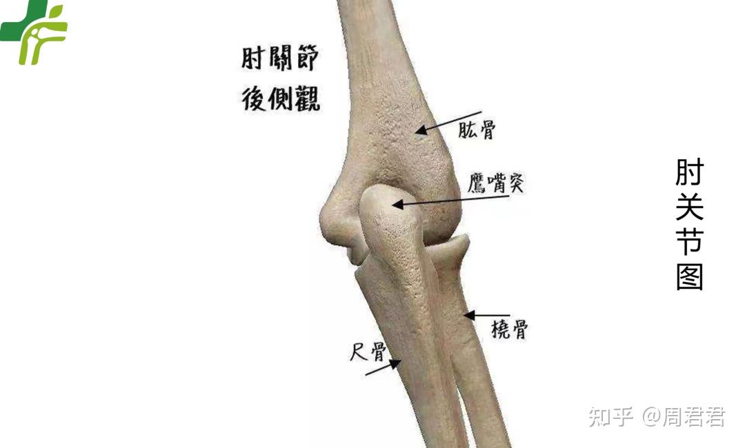 三口品牌故事三口伯伯说骨事肘关节之尺骨鹰嘴骨折和桡骨头骨折