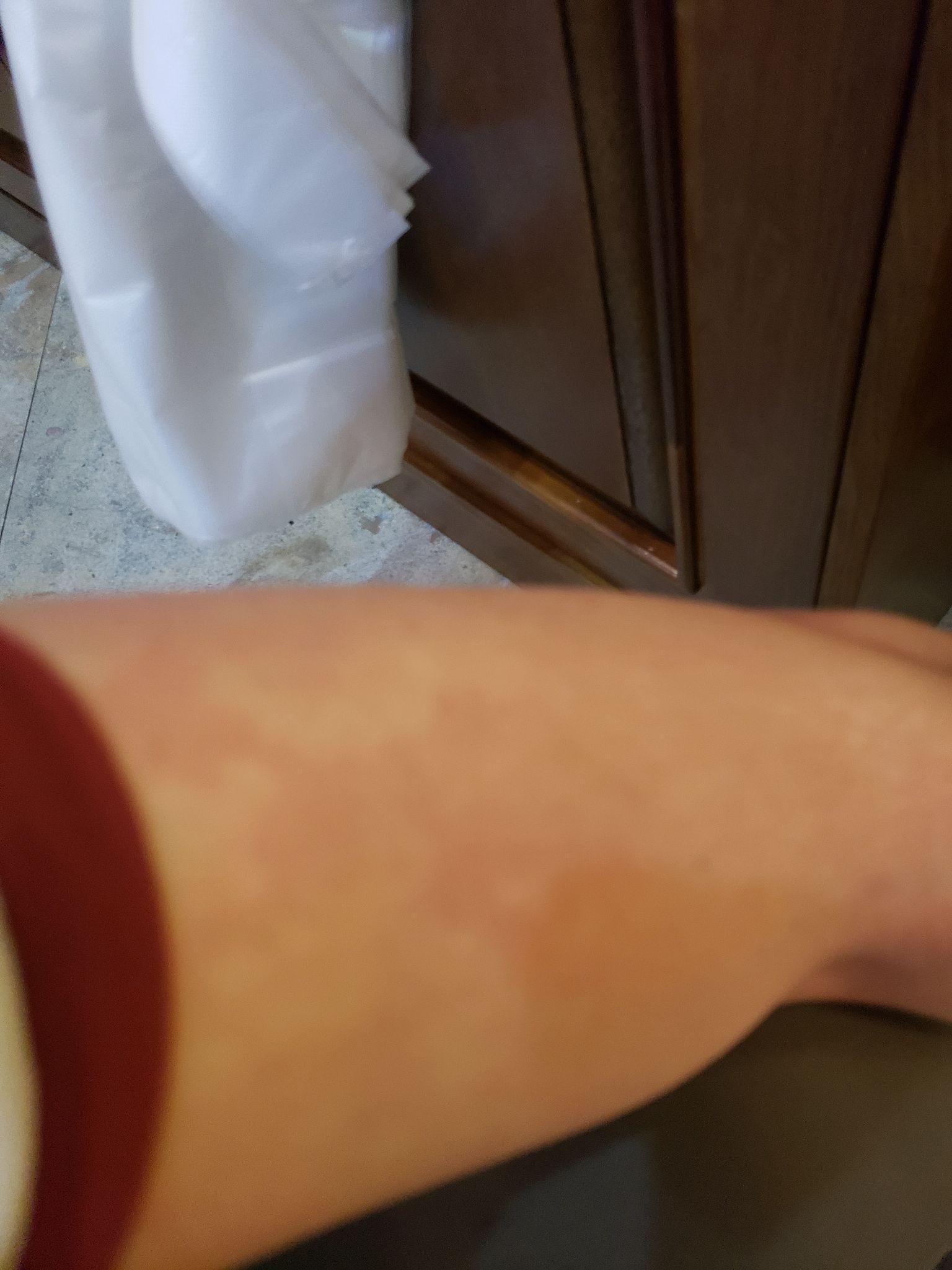 父亲嗜酒如命,儿子酒精过敏是种什么体验?