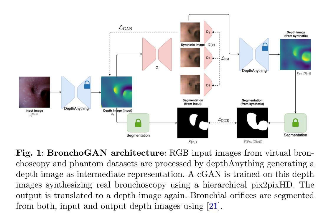 GAN