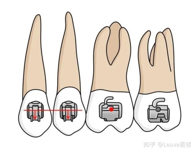 颊面管的作用图片