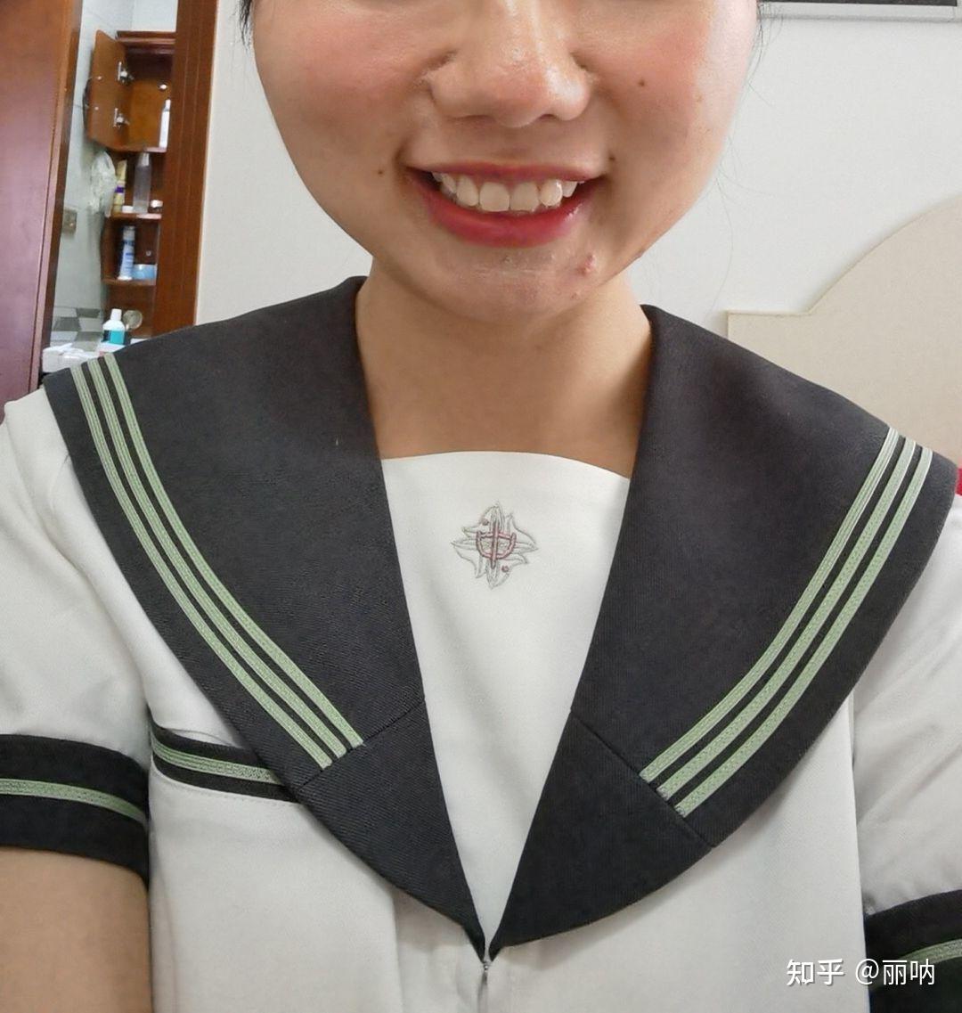 郭麒麟鼻子两边一笑会把脸皮拽起来的两块小肉,是因为整形手术收鼻翼