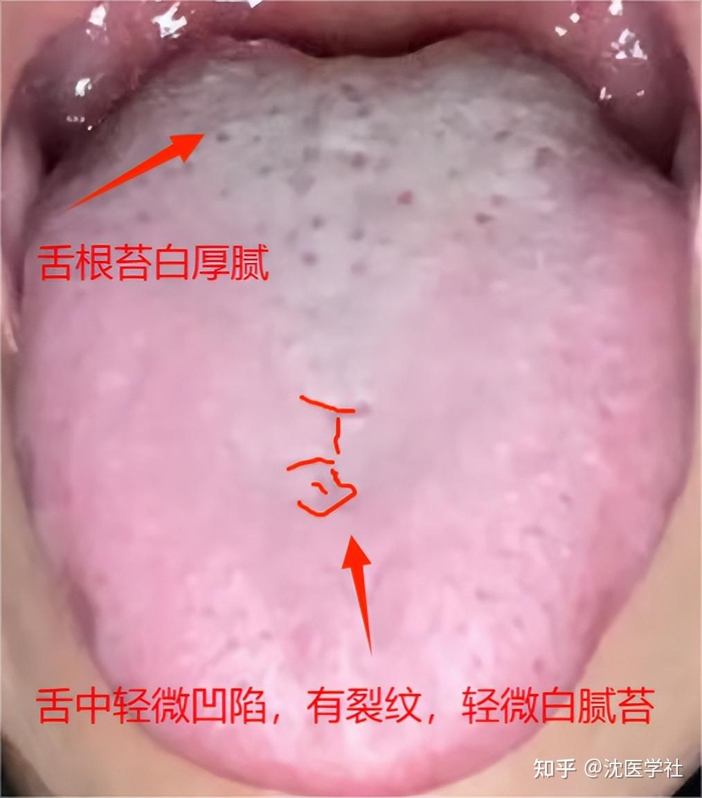 年轻用手频繁，中年时短疲软，要想力挽狂澜，第一步就得这样做- 知乎