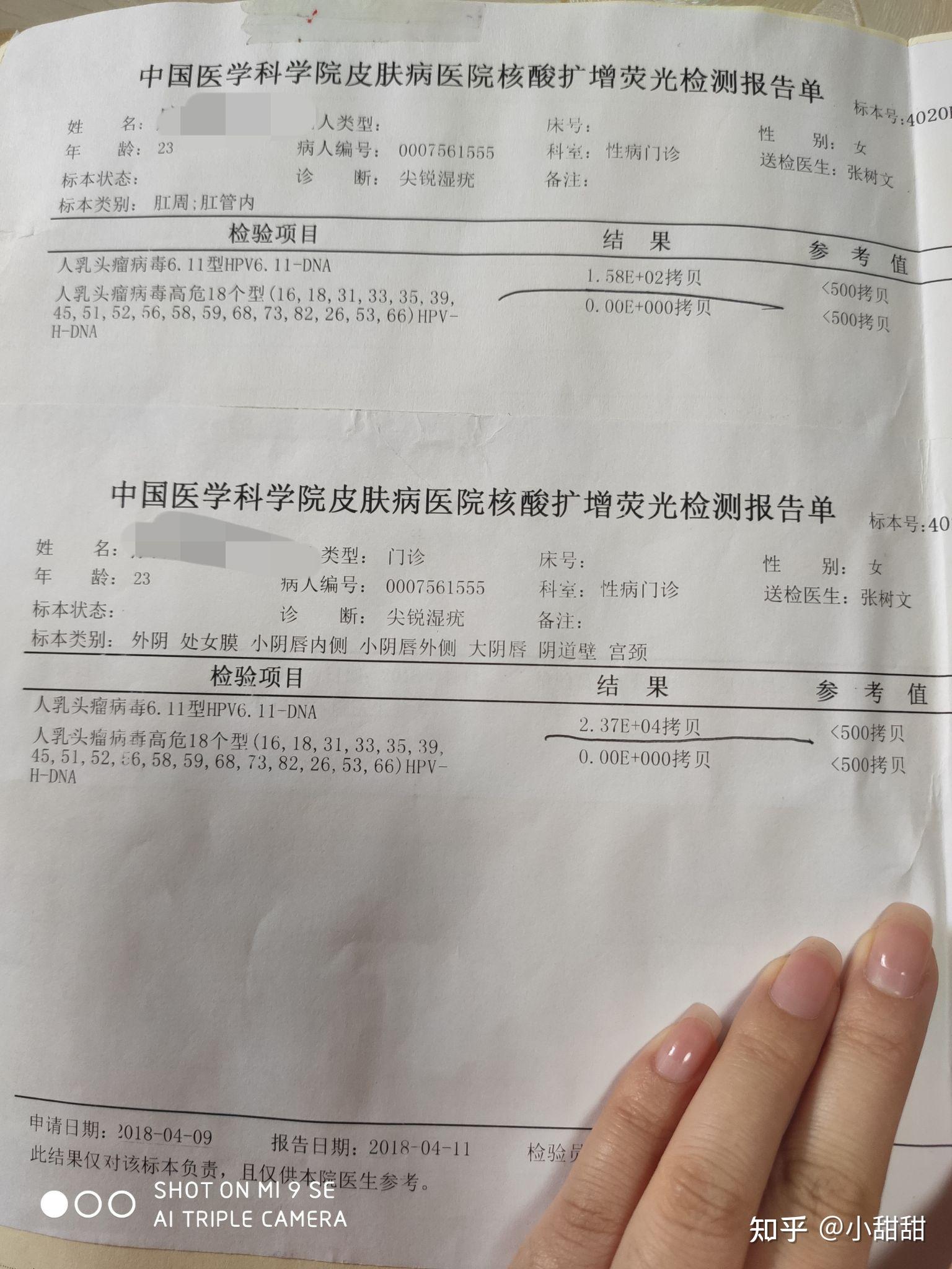 hpv检查结果图片