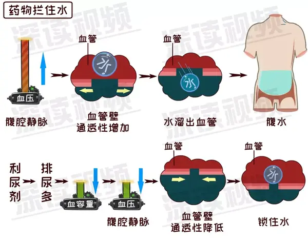 偏瘦男子突然大肚肝腹水从何来肝腹水前世今生唯美动漫版