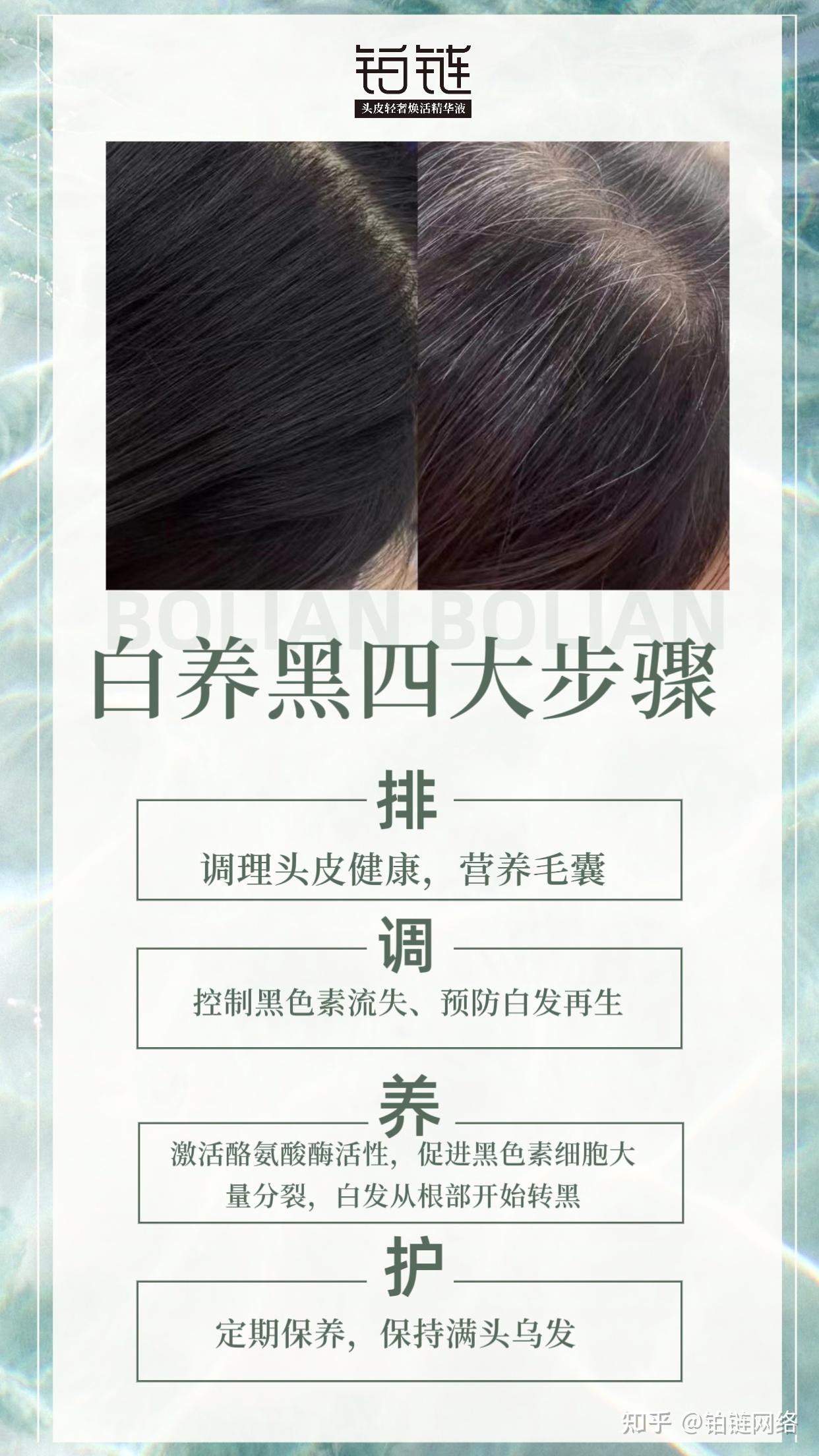 白发必看-白发养黑关键点 - 知乎