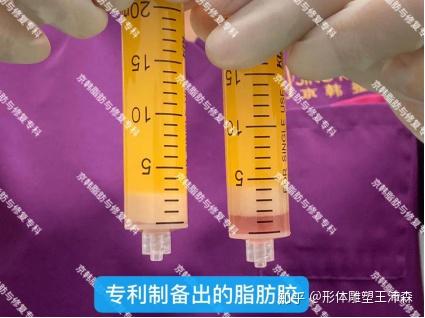 解析：脂芯SVF-gel脂肪胶是什么？它长什么样子？ - 知乎