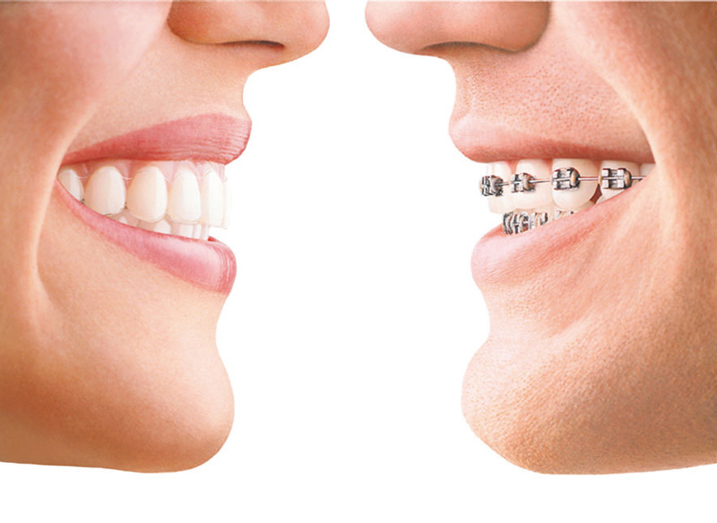 v2-8e8dd46a98590899a6fac812b9e42840_1440w.jpg?source=172ae18b