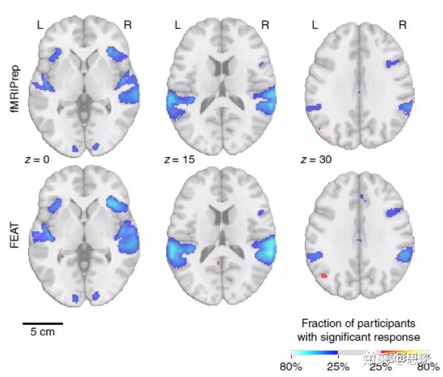 Nature Methods:fMRIPrep: 一个稳定的fMRI数据预处理工具 - 知乎