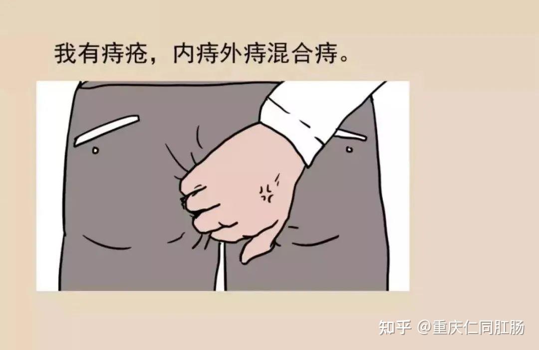重庆哪些医院肛肠科较好痔疮出血要不要紧