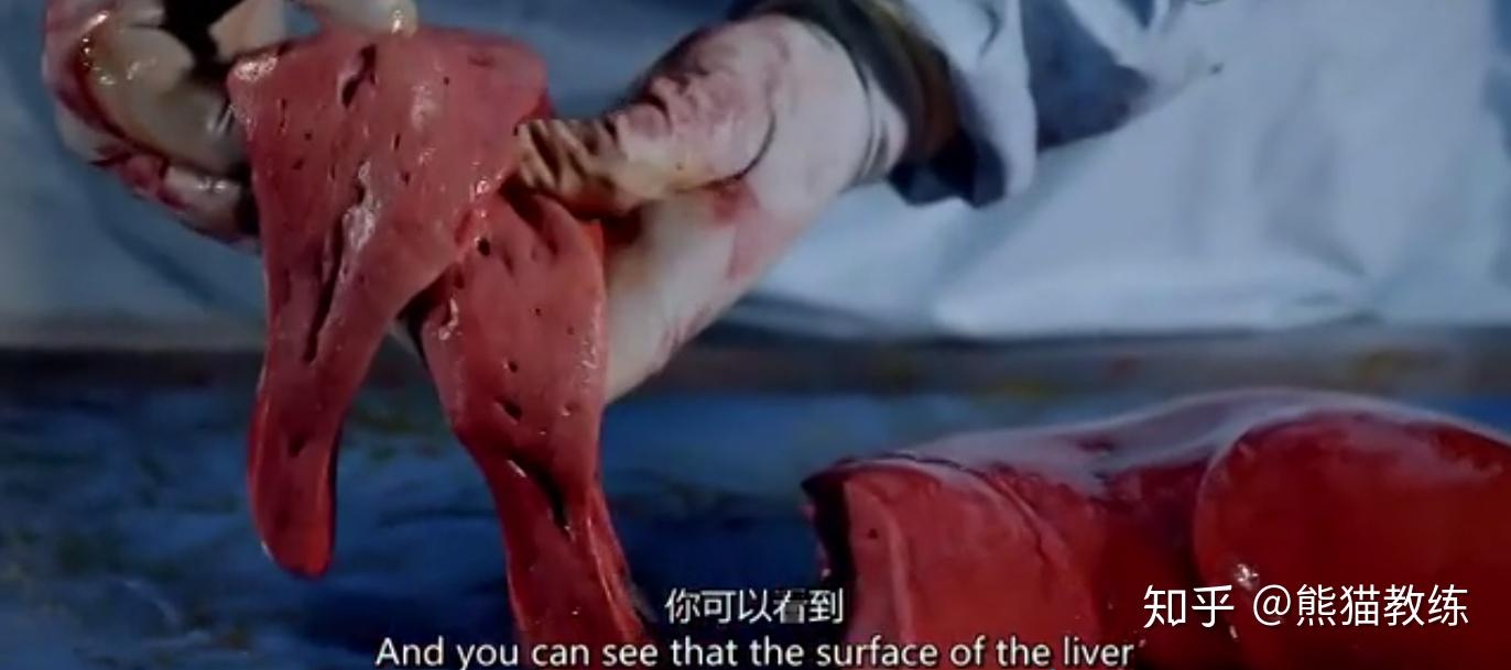 瑟瑟发抖肥胖对身体影响有多大bbc解剖了一位200斤的胖子