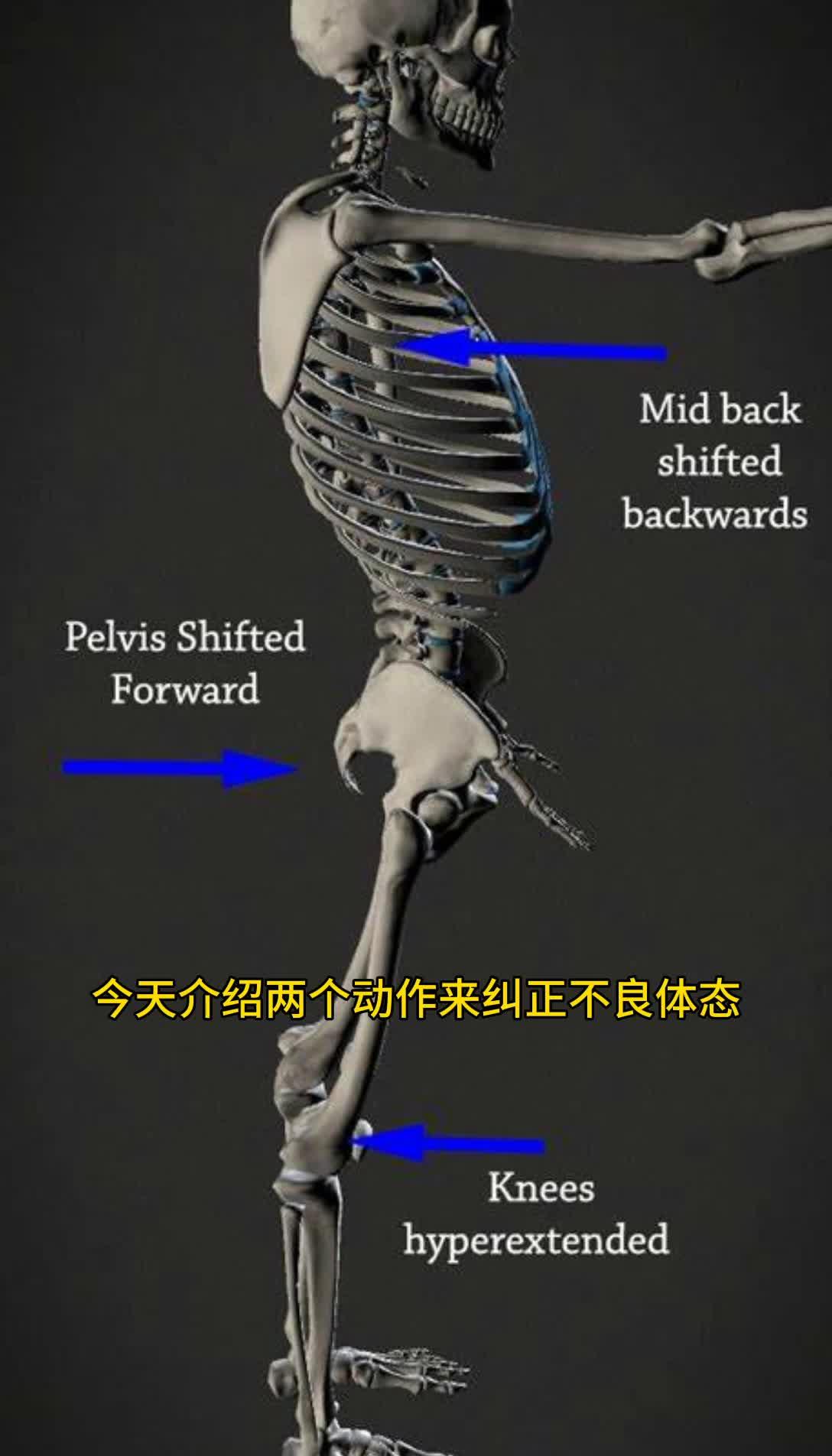 自我矯正教程兩個動作糾正骨盆前移