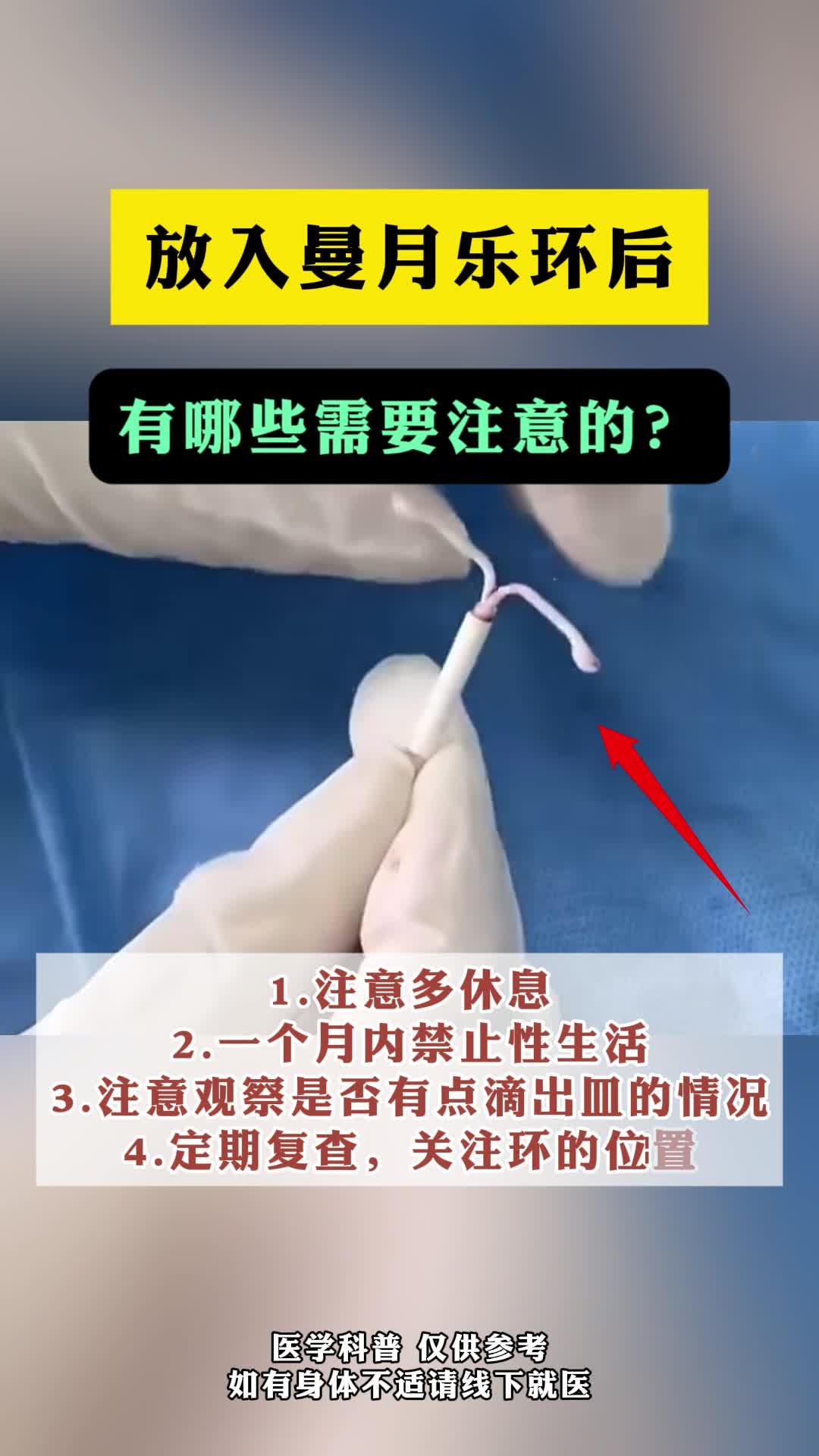 放入曼月乐环后,有哪些需要注意的?