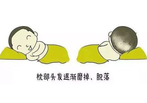 宝宝后脑勺出现枕秃是正常现象但如果是这个原因家长必须重视