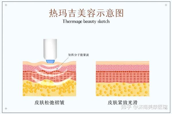 抗衰的医美项目你知道那些? - 知乎