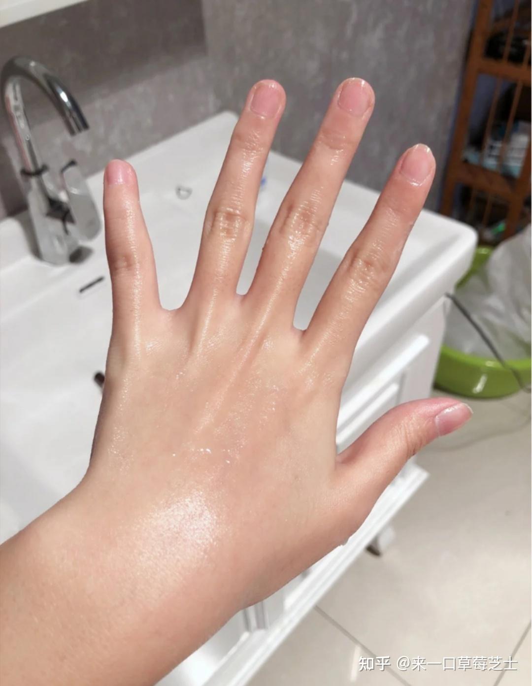 女生手指关节发黑何解决? - 知乎