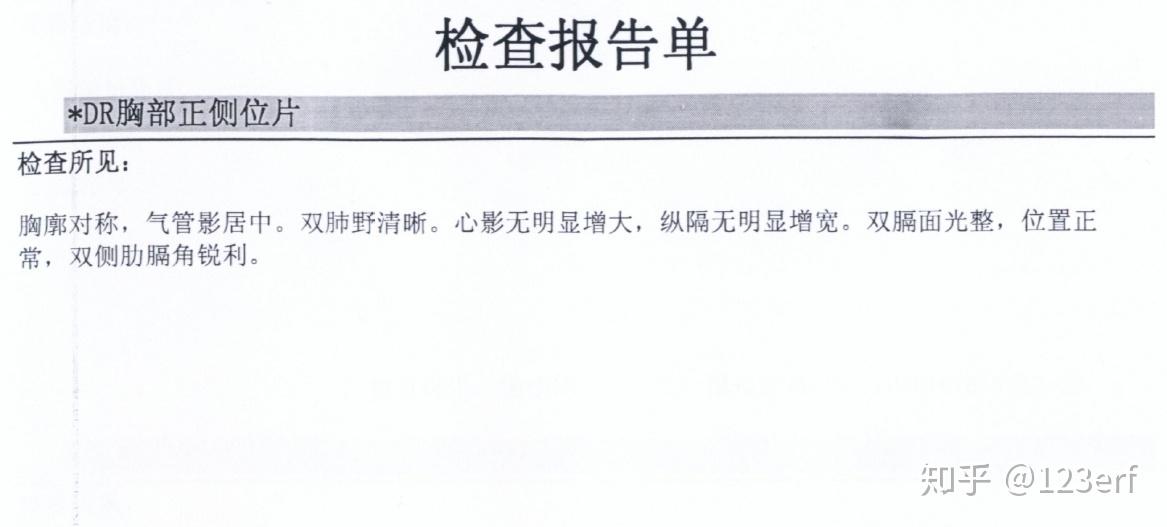 怎么戒掉烟的 v2-8f8d66bfced59b3489e0062f41c2a6e4_r.jpg