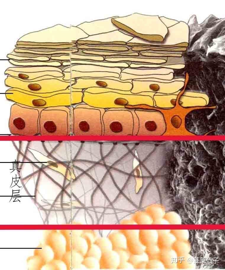 真皮网状层图片